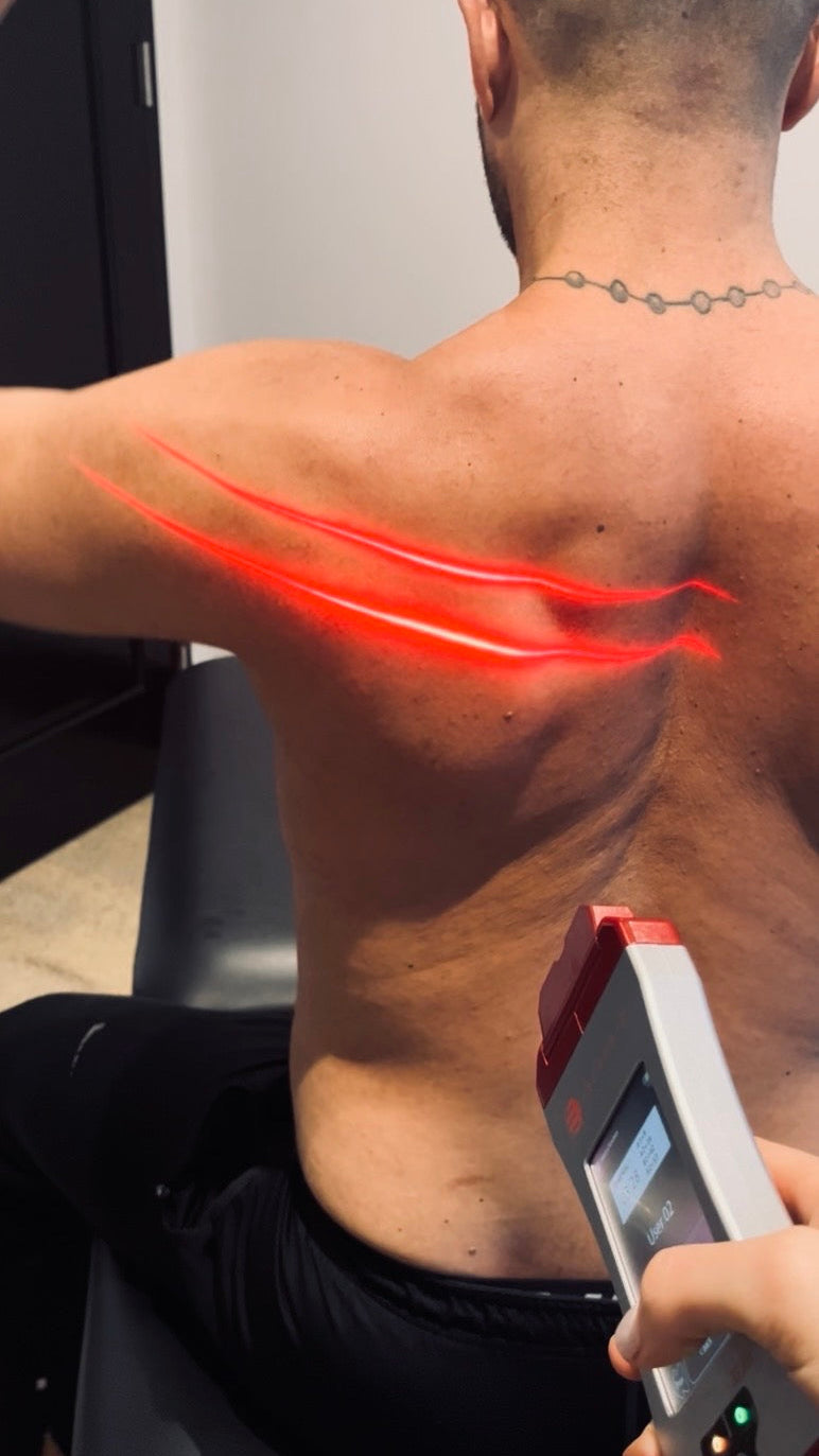 Melissa karagianis using cold laser to treat rotator cuff tear in mississayga